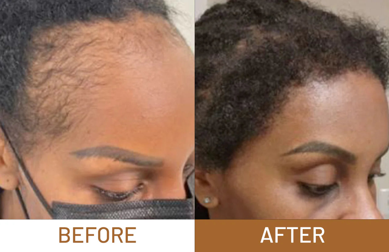 Batana Oil Pure Luxe Hair Boost Hair Growth Oil