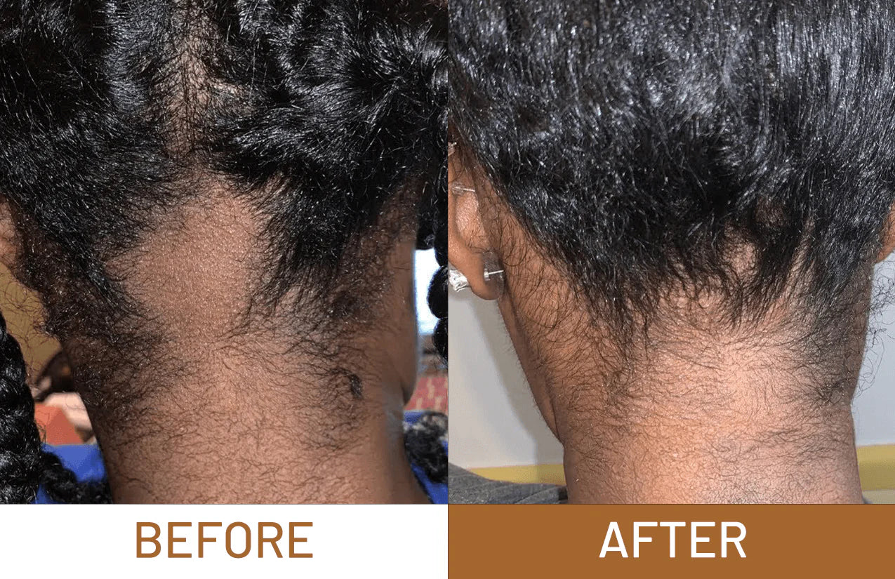 Batana Oil Pure Luxe Hair Boost Hair Growth Oil