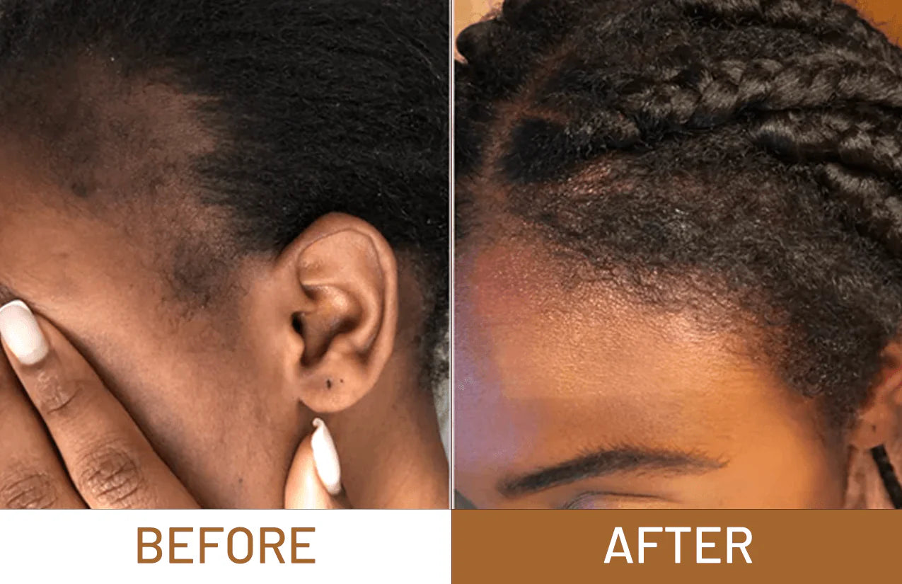 Batana Oil Pure Luxe Hair Boost Hair Growth Oil