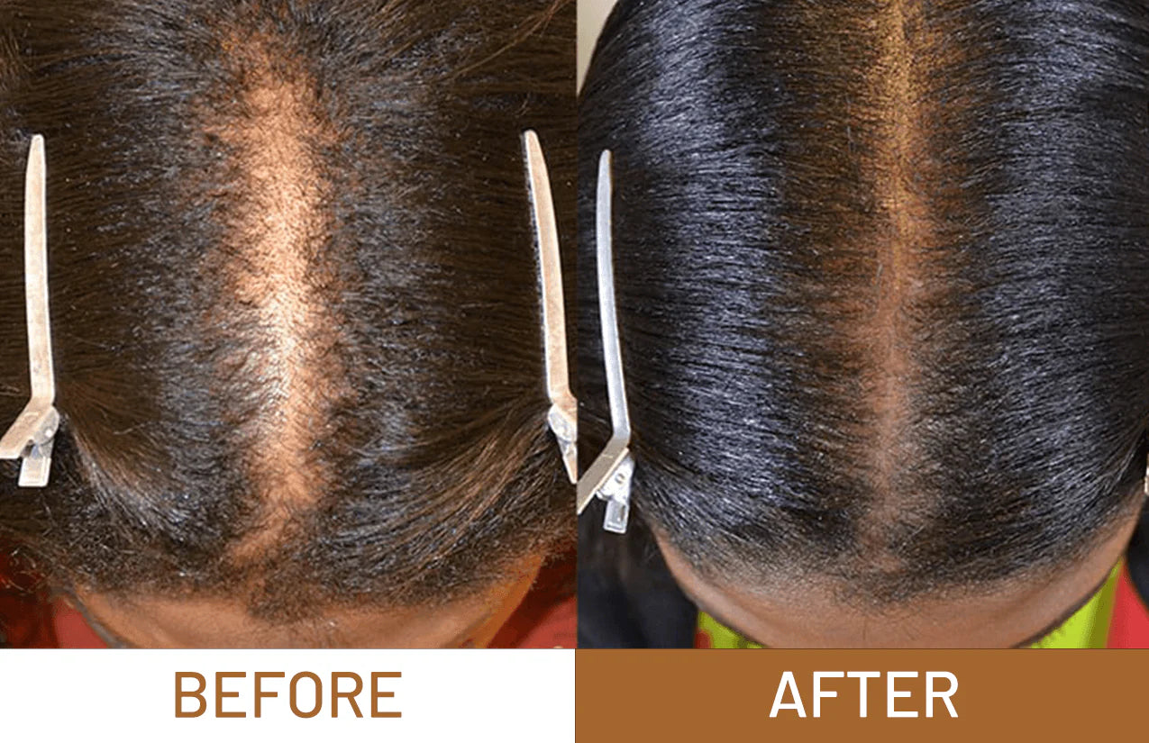 Batana Oil Pure Luxe Hair Boost Hair Growth Oil