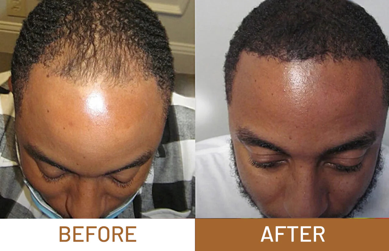 Batana Oil Pure Luxe Hair Boost Hair Growth Oil