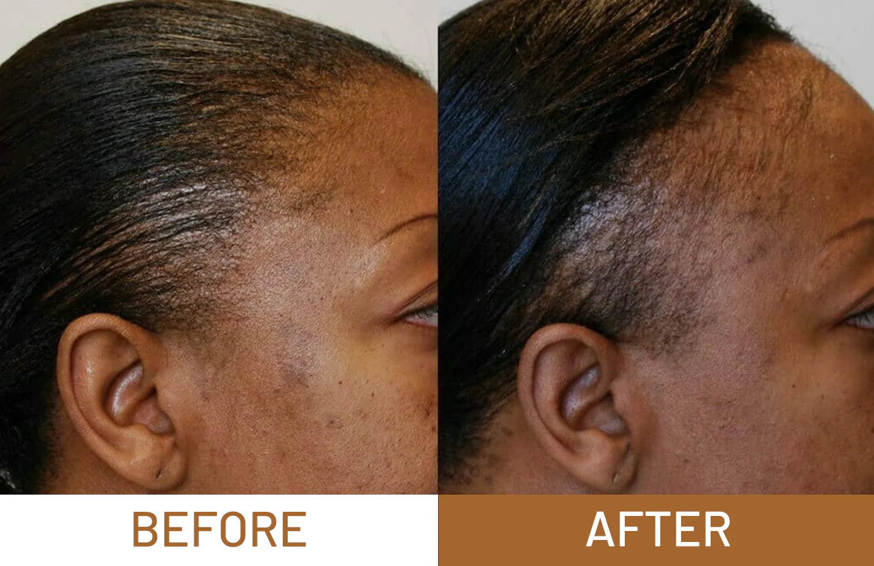 Batana Oil Pure Luxe Hair Boost Hair Growth Oil